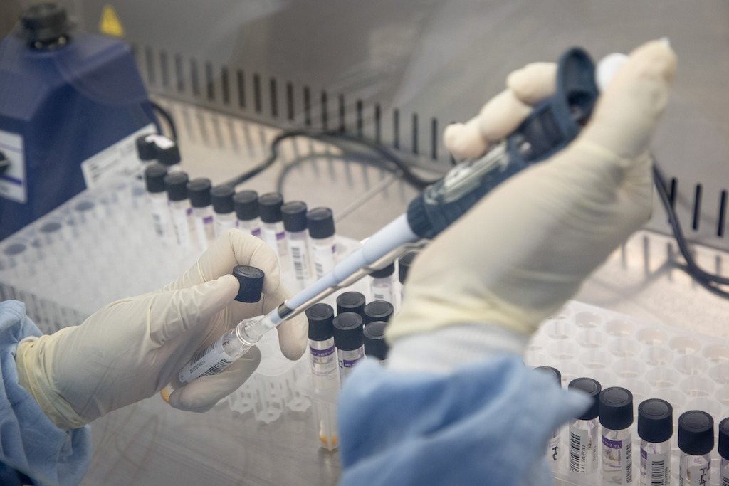 Bacteria culture tubes for BACTEC™ MGIT™ 960 Mycobacterial detection system in the National TB Reference Laboratory. This device helps grow and detect TB bacterias and determine drug resistances.<br/>Government Hospital, Mbabane, Swaziland. Photographer: Alexis Huguet