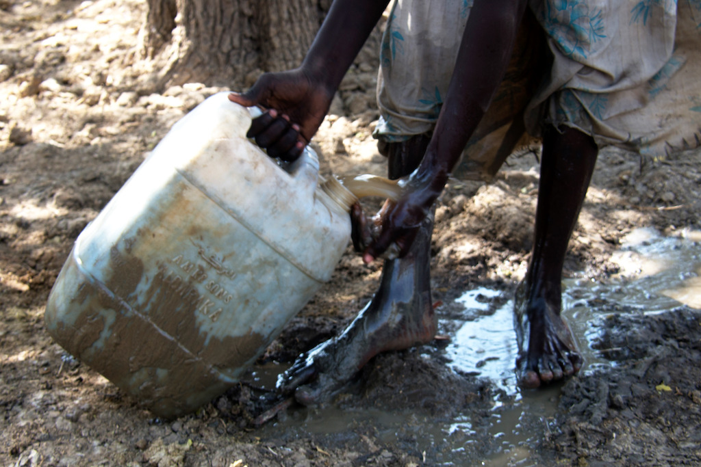 Fatima Abdelkarim, 16 years old, washes her feet. She is living in the village of Amchoka. Women and girls often bear the burden of walking miles at a time to gather water from streams and ponds. A lack of access to clean and safe water creates ideal conditions for faecal oral diseases like hepatitis e to thrive. Salamat Region of Chad. Photographer: Abdoulaye Barry/MSF