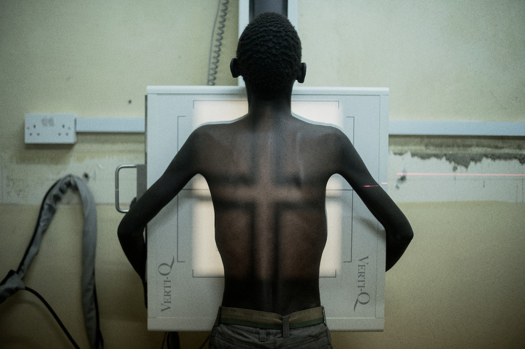 Nsanje, Malawi: Simbazako, 19 years, undergoes radiography for tuberculosis in Nsanje district hospital, Malawi. He says: “I feel too much pain in my ribs. I take my ARVs without skipping even a day but my health is not improving as I had expected.” <br/><br/>MSF is working with medical teams in Nsanje district hospital to improve diagnosis and clinical care of AIDS, including imaging, laboratory and pharmacy support. Photographer: Luca Sola