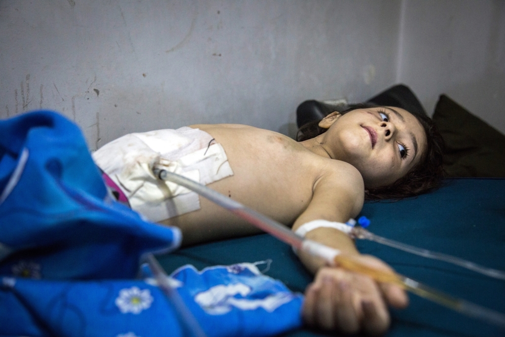 A five-year-old child recovers from surgery to his abdomen after being hit by shrapnel in an airstrike on Al Sukkari neighbourhood in east Aleppo. Photographer: KARAM ALMASRI