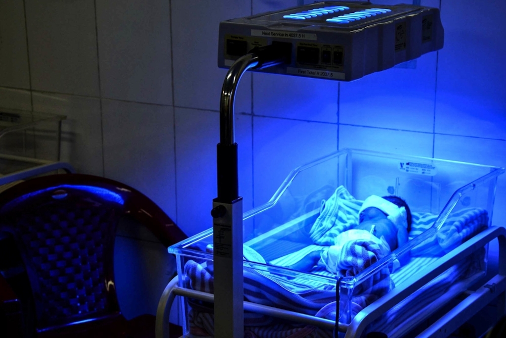 Jaundice is a complication that can affect newborns, but can be treated by exposure to Ultra-Violet (UV) light under a phototherapy lamp. Photographer: Kate Stegeman/MSF