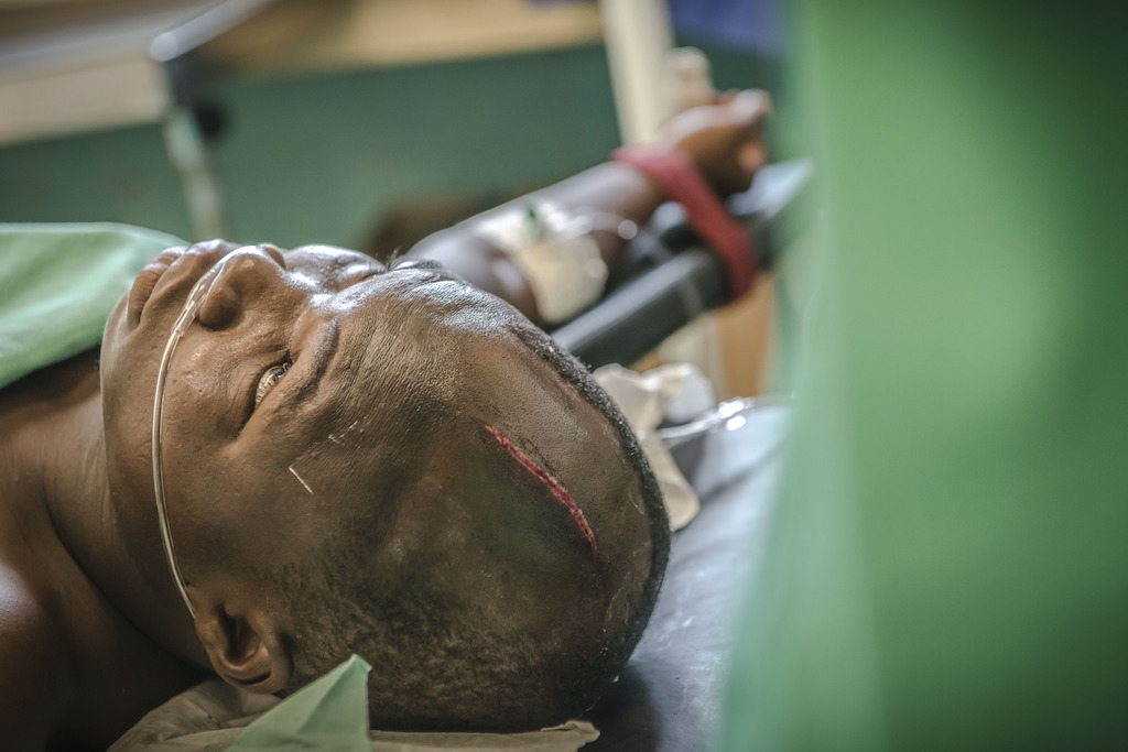 Wounded patient with machete cut on the head at Berberati Regional University Hospital. Photographer: Yann Libessart