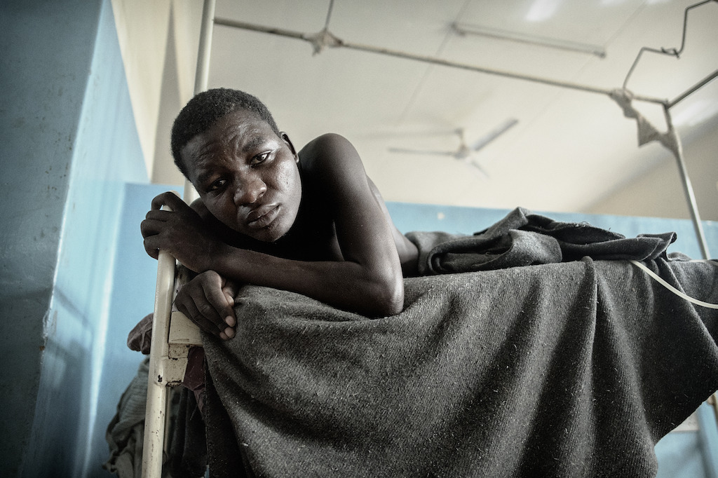 Nsanje, Malawi: Misheck, 29 years, from Mozambique come to Malawi for work. After one month, he had a malaria attack. During his stay at Nsanje district hospital, he was diagnosed HIV positive with severe immune failure. <br/><br/>“I am feeling a bit better but I still cannot move. When I get better, I plan to stay in Malawi because where I come from, stigma is very high towards people who are HIV positive like me. Here in Malawi, people support each other.” Photographer: Luca Sola