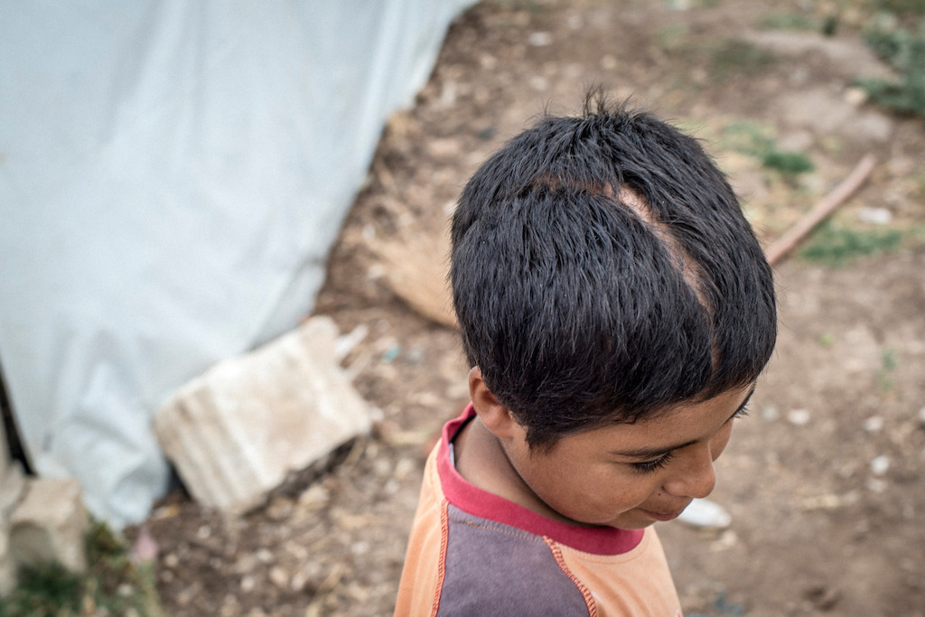 © Benoit Almeras / Handicap International