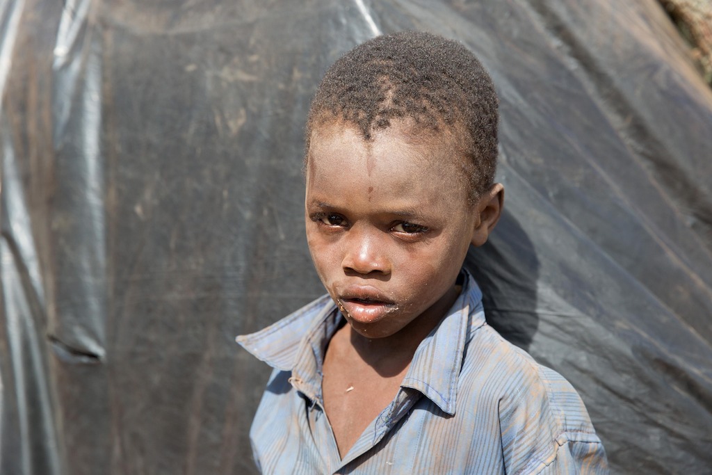 Portrait of a child who is one of over 5.800 Mozambican nationals have camped in the village of Kapise 2 in Malawi after fleeing their homes in Mozambique, the majority of them women, children and the elderly. © James Oatway / MSF