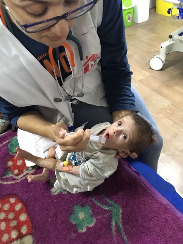 MSF Treats First Cases of Malnutrition Among People Displaced from West Mosul. As the exodus from Mosul continues, camps for displaced persons are filling up. Among the population who fled the neighborhoods of west Mosul, Doctors Without Borders/Médecins Sans Frontières (MSF) teams are seeing new patients—children, mostly babies—suffering from malnutrition. Photographer: MSF