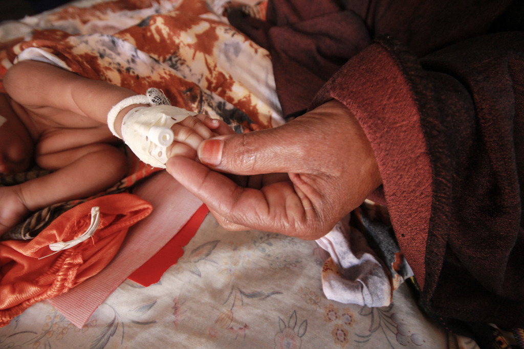 A newborn child receives care at MSF's hospital in Dagahaley refugee camp, Dadaab, Kenya. Photographer: Tom Maruko