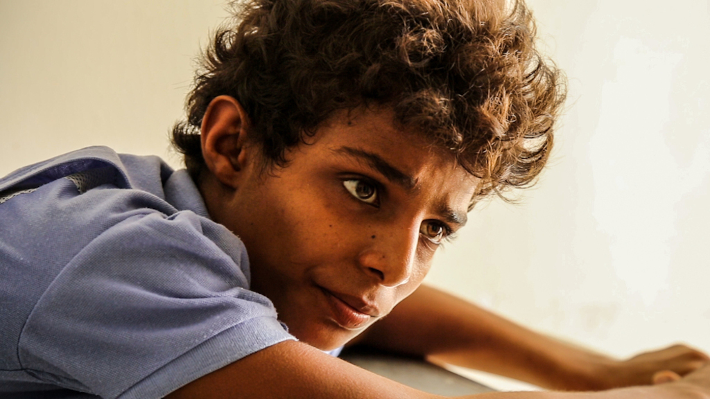 Sami (15-years-old) was brought to Abs hospital after an airstrike hit his parents farm in Al-Arf village.<br/>Him and his brother suffered serious injuries. Sami´s right foot was so severely damaged that his leg had to be amputated.<br/><br/>Now Sami needs regular surgical care in order to heal properly. Here he is pictured waiting for his wound to be cleaned by MSF doctors. Photographer: MSF