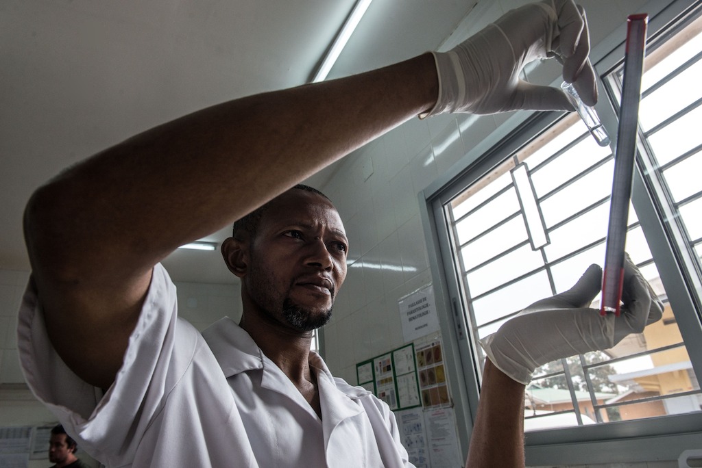 Medecins Sans Frontieres (MSF) laboratory technician Gentile Lusamba examines cerebral spinal fluids from an HIV patient in the laboratory of the Kabinda Hospital in Kinshasa, Democratic Republic of Congo. Photographer: Tommy Trenchard