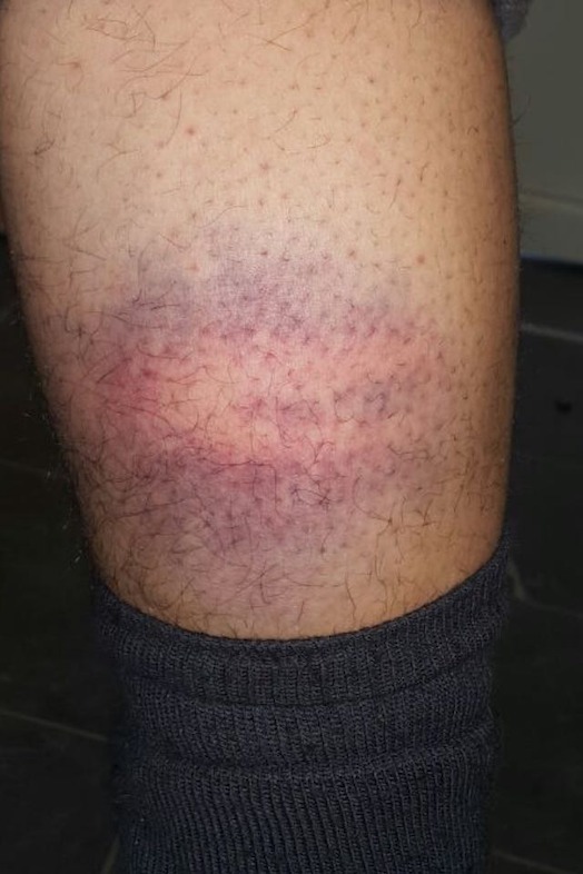 Alleged Police Abuse On The Hungarian Border