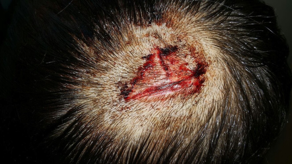 Alleged Police Abuse On The Hungarian Border