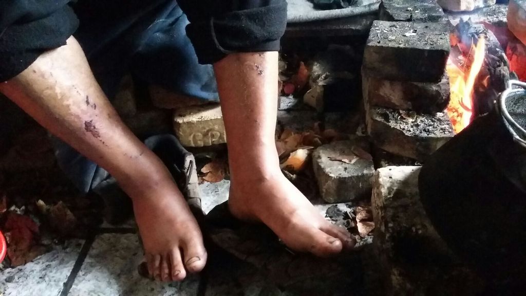 Alleged Police Abuse On The Hungarian Border