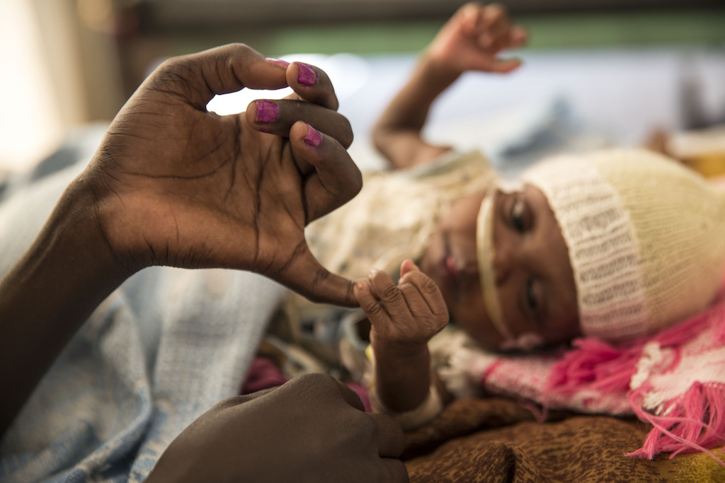 De vier maand oude Mary James ligt met tuberculose in het ziekenhuis van Artsen Zonder Grenzen in het VN-vluchtelingenkamp van Malakal, in Zuid-Sudan. Sara, haar moeder, hoopt snel met haar naar huis te kunnen gaan, als het geweld in de regio tenminste gaat liggen en als Mary James genezen is ©Anna Surinyach/MSF