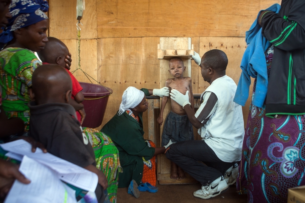A severely malnourished child is being measured at an MSF supported health center in Bukama, Masisi, North Kivu, February 8, 2017. Photographer: Gwenn Dubourthoumieu