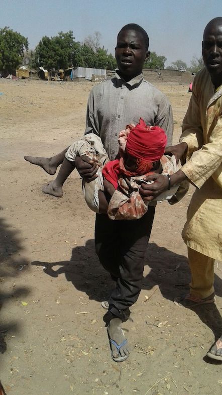 A bombing by the Nigerian Army has occurred in an internally displaced person camps in Rann, Nigeria. MSF teams have seen 120 wounded and at least 50 dead following the bombing. Teams are trying to provide emergency first aid in its facility and are stabilizing patients to evacuate wounded. We are asking the authorities to put all measures in place in order to facilitate the emergency evacuation of wounded (by air and land). Our medical and surgical teams in Cameroon and Chad are ready to treat wounded patients. Photographer: MSF