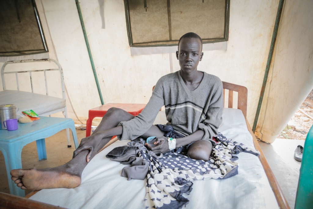 Banywich Bone, 18 ans, was reffered to Agok From Mayom, where MSF runs a primary health center. He was bitten by a snake three years ago, while he was sleeping at home. When he arrived in the hospital, he presented an infected wound for which doctors blame the snake bite. His left leg had necrotic tissus and pain, the wound was infected and MSF surgeon had to amputate the leg above the knee. Photographer: Pierre-Yves Bernard