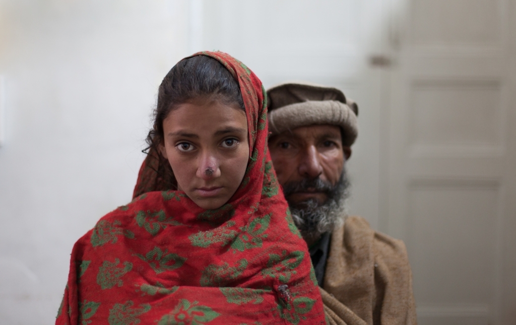 System identifier<br/>: MSF147866<br/>Title<br/>: Pakistan Behind The Headlines<br/>Photographer / cameraman<br/>: Sa'adia Khan<br/>Countries:<br/>Pakistan<br/>Description<br/>: Mohammad Akhtar 40 years old with his daughter Rubbina 10. From Mamozai - took<br/>them 6 hours to get to the hospital by foot. His wife has a kidney problem. 7 children. Rubbina has<br/>Leishmaniasis - skin condition