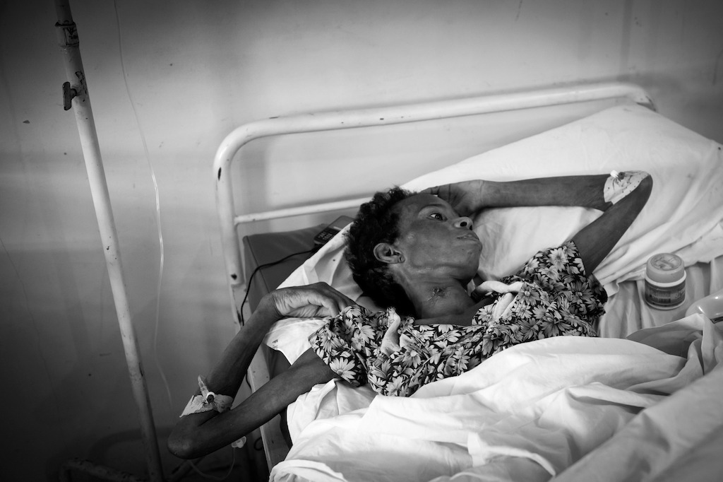 Kinshasa, DRC: At the Centre Hospitalier de Kabinda (CHK) in Kinshasa, MSF has observed an excessively high number of patients arriving with serious complications resulting from lack of treatment. The number of HIV-positive people in DRC is currently estimated at more than one million, 350,000 of whom could benefit from ARV treatment. However, only 44,000 are receiving treatment at this time. This represents a 15 percent ARV coverage rate, one of the lowest in the world (of all African countries, only Somalia and Sudan have similar rates). Credit: Mario Travaini/MSF