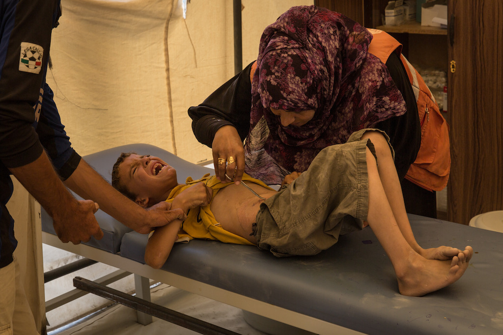 Juillet 2017 - Syrie - Rojava - Noord-Syrië, het vluchtelingenkamp van 'Aïn Issa / Kliniek AZG/ Een jonge Syriër uit Raqqa wordt behandeld voor zijn snijwonden.<br/>Chris Hubby