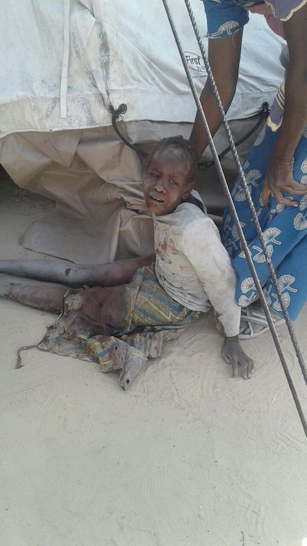 Victims of bombing on a displaced camp in Rann, Nigeria